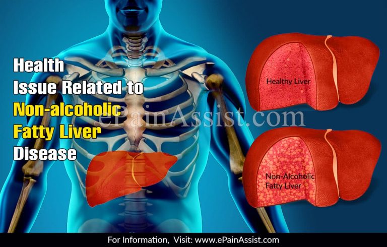 Increased Risk of Non-Alcoholic Fatty Liver Disease in Obese Persons