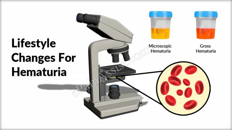 Lifestyle Changes For Hematuria