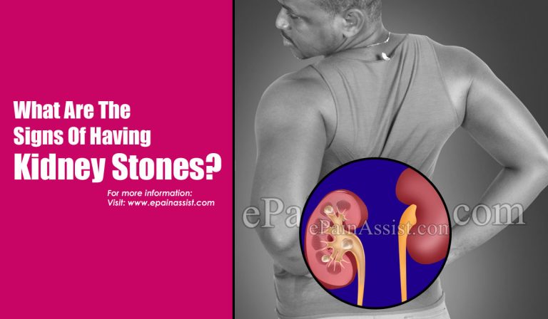 What Are The Signs Of Having Kidney Stones?