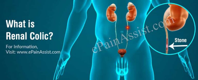 What Is Renal Colic: Causes, Symptoms, Treatment, Diagnosis And How Long Does It Last?