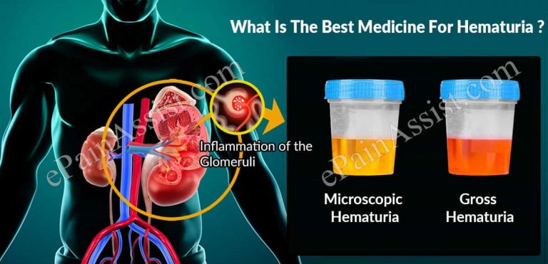 What Is The Best Medicine For Hematuria?