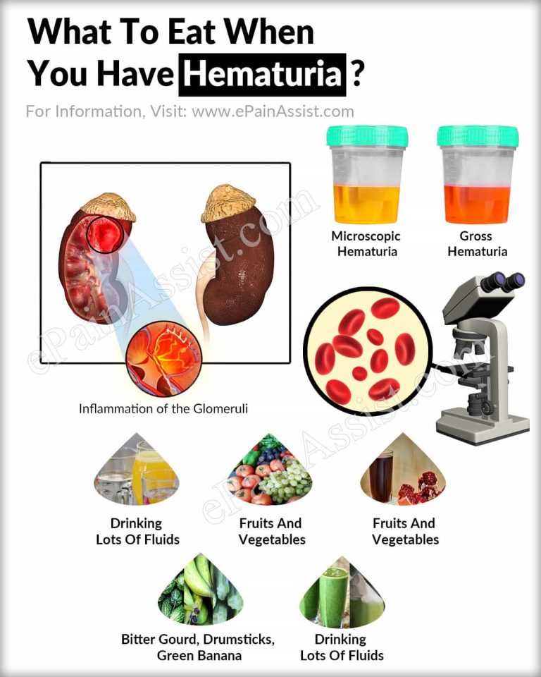 What To Eat When You Have Hematuria?
