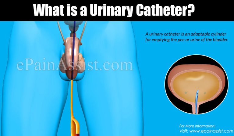Urinary Catheter: Uses, Types, Effects on Sex life and Preventing Contamination