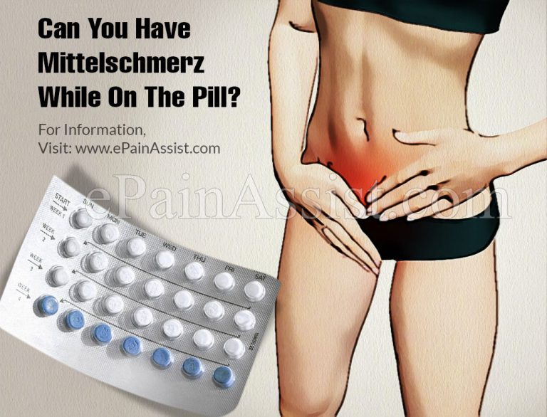 Can You Have Mittelschmerz While On The Pill?
