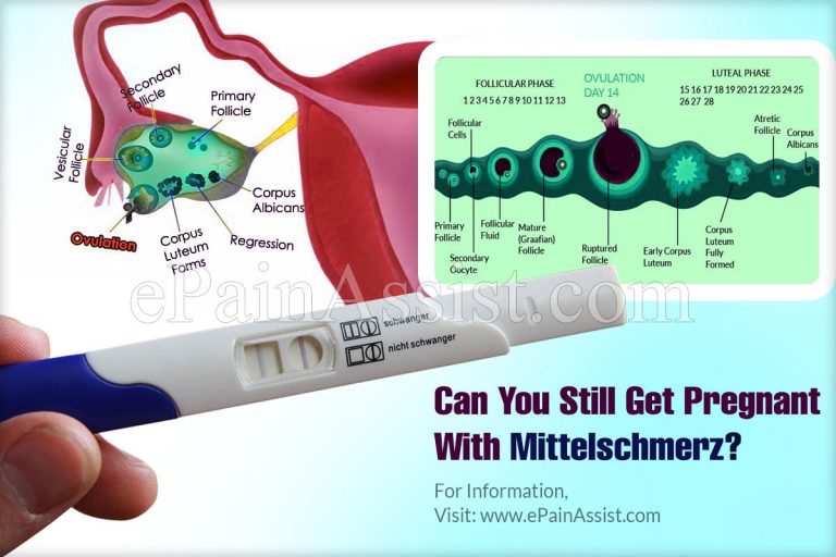 Can You Still Get Pregnant With Mittelschmerz?