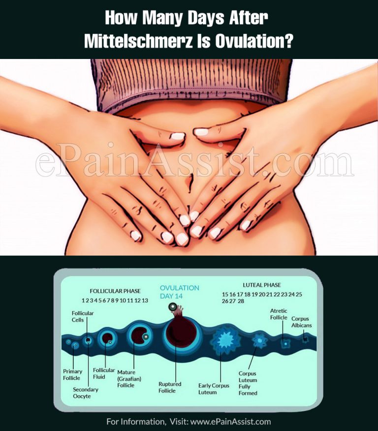 How Many Days After Mittelschmerz Is Ovulation?