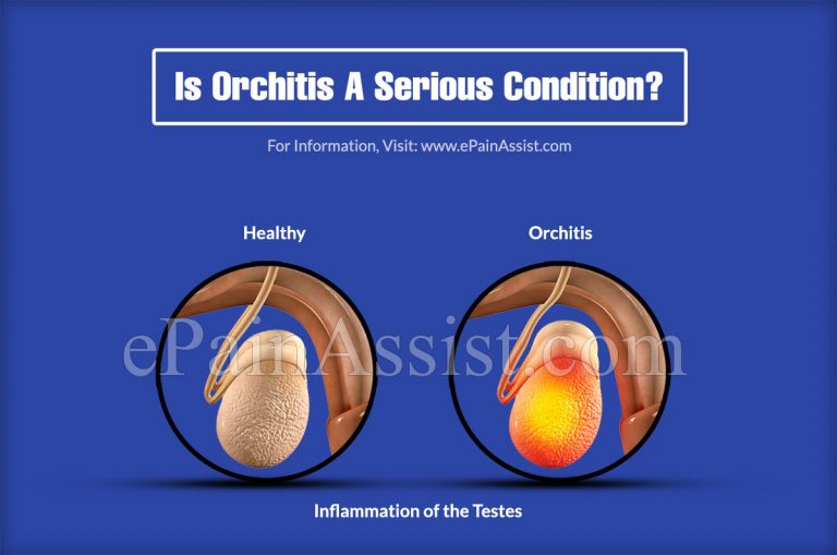 Is Orchitis A Serious Condition & Can It Be Reversed?