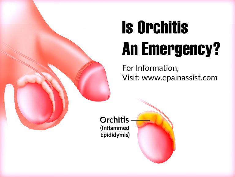 Is Orchitis An Emergency & What Antibiotics Treat Orchitis?
