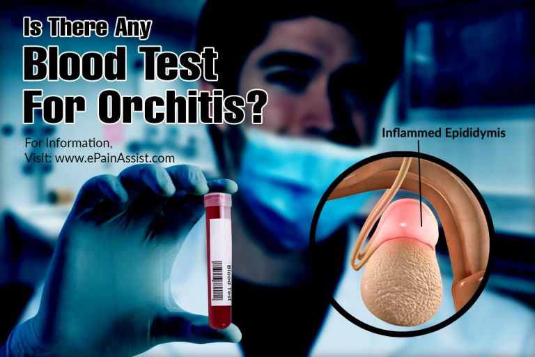 Who Is At Risk For Orchitis & Is There A Blood Test For It?