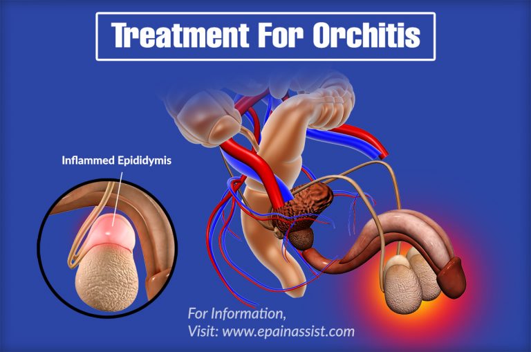 What Is The Best Treatment For Orchitis & Coping Methods For It?