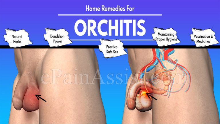 Best Exercises/Activities/Home Remedies For Orchitis