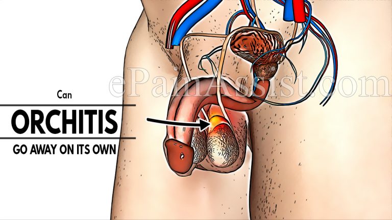 Can Orchitis Go Away On Its Own & How Do You Treat It Naturally?