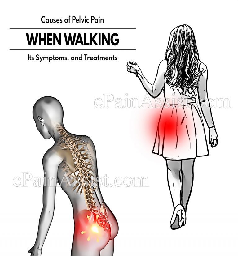 Causes of Pelvic Pain When Walking, Its Symptoms, and Treatments