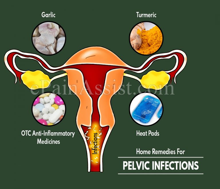 Home Remedies – Best Exercises – Activities For Pelvic Infection