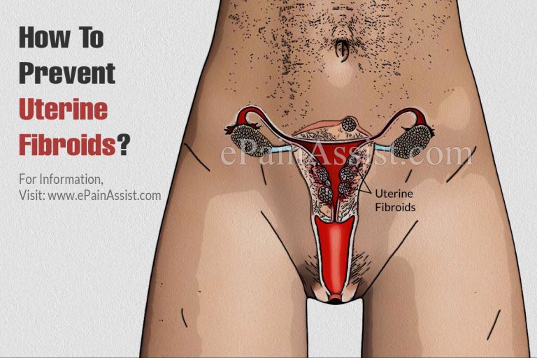 How To Prevent Uterine Fibroids?
