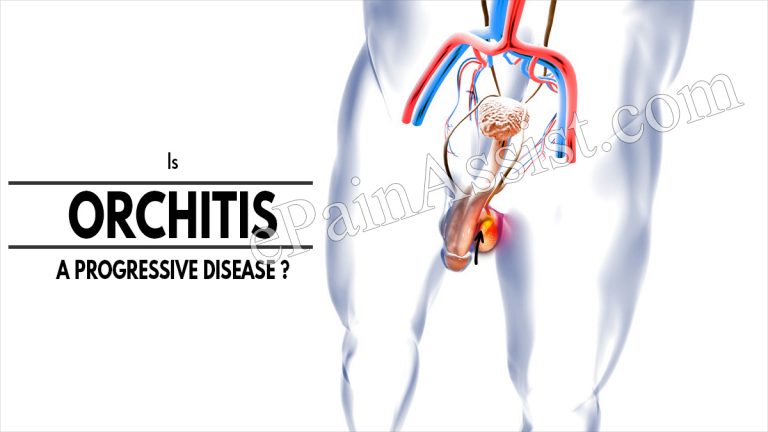 Is Orchitis A Progressive Disease & Alternative Treatments For It?