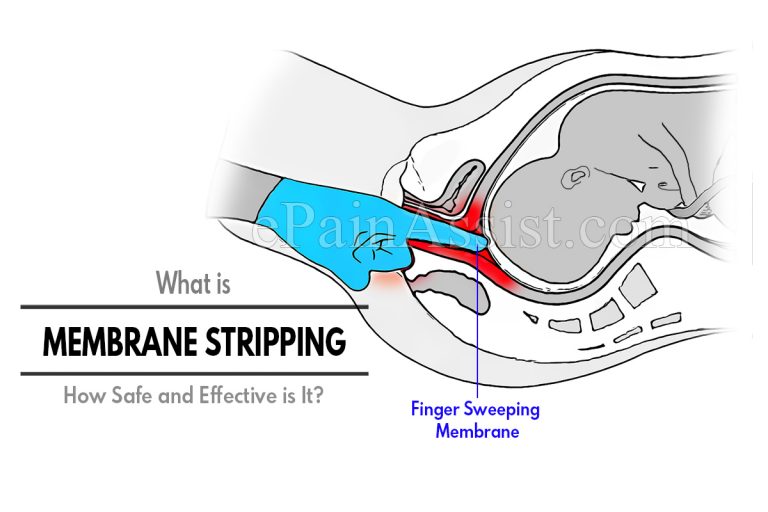 What is Membrane Stripping & How Safe and Effective is It?