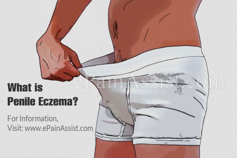 Penile Eczema: Causes, Symptoms, Treatment, Diagnosis
