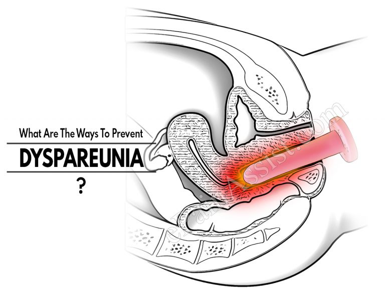 What Are The Ways To Prevent Dyspareunia & Does It Reoccur?