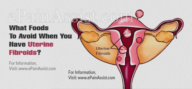 What Foods To Avoid When You Have Uterine Fibroids?