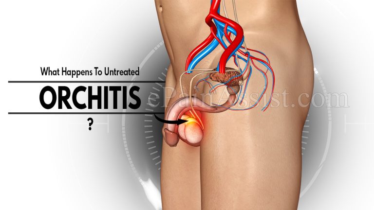 What Happens To Untreated Orchitis & When to Go to Doctor?