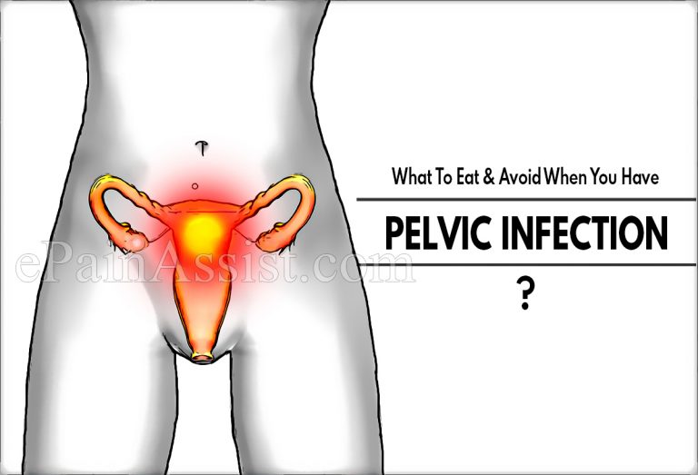 What To Eat & Avoid When You Have Pelvic Infection?