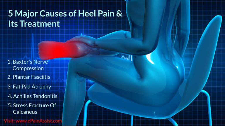 5 Major Causes of Heel Pain