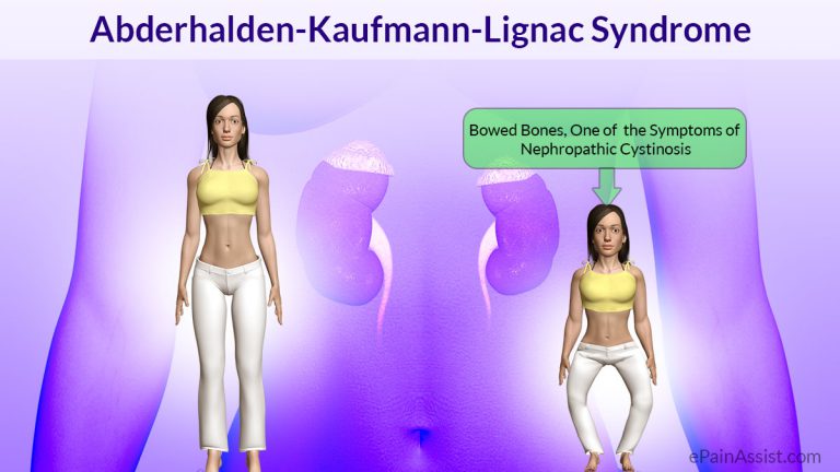 Abderhalden-Kaufmann-Lignac Syndrome or Nephropathic Cystinosis: Causes, Symptoms, Treatment