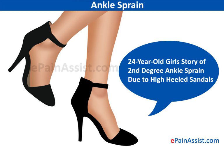 24-Year-Old Girls Story of 2nd Degree Ankle Sprain Due to High Heeled Sandals