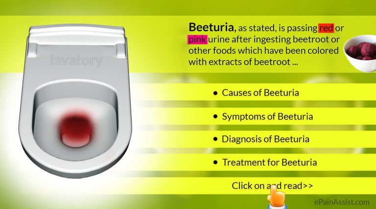 Beeturia: Causes, Symptoms, Diagnosis, Treatment- Water Intake, Iron Pills, Beetroot