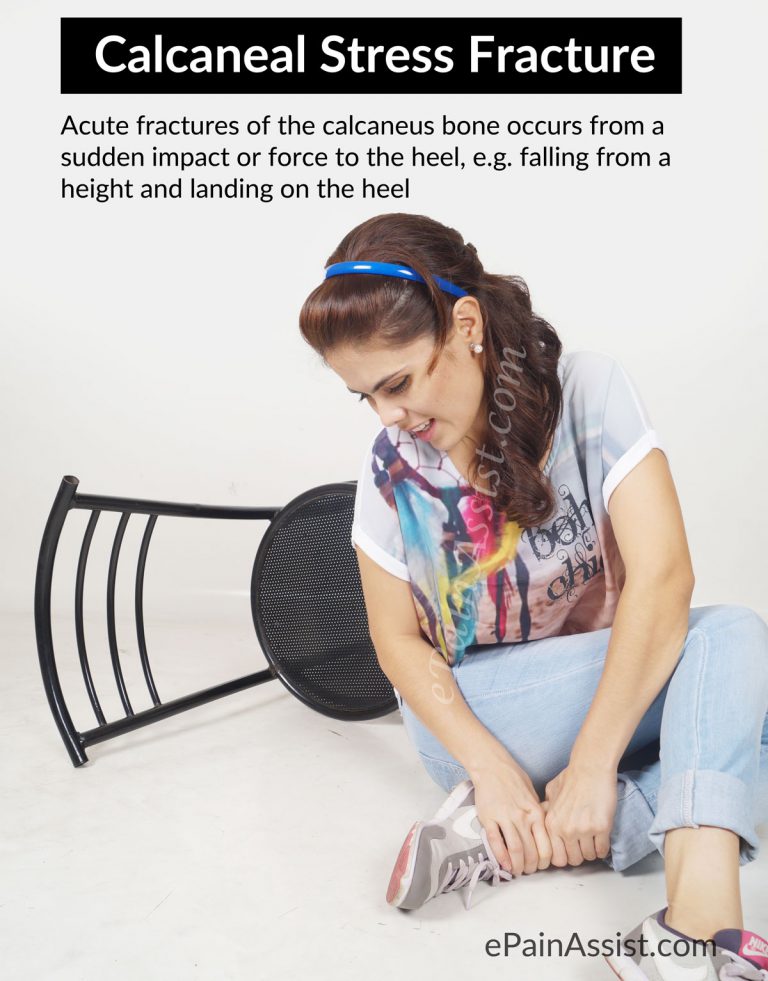 Calcaneal Stress Fracture: Causes, Symptoms, Treatment- Heel Pad, Plaster Cast, Rehab