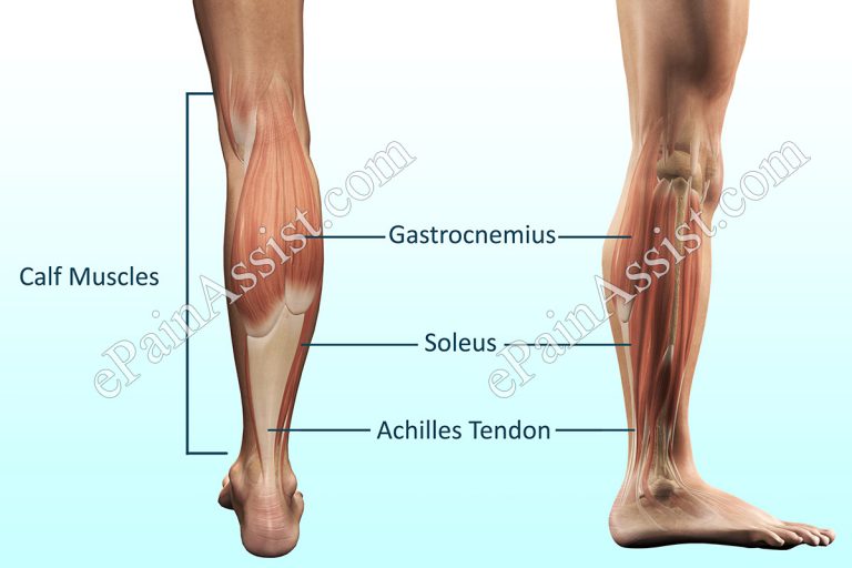 Calf Pain or Calf Muscle Pain: Causes, Diagnosis, Investigations, Treatment, PT