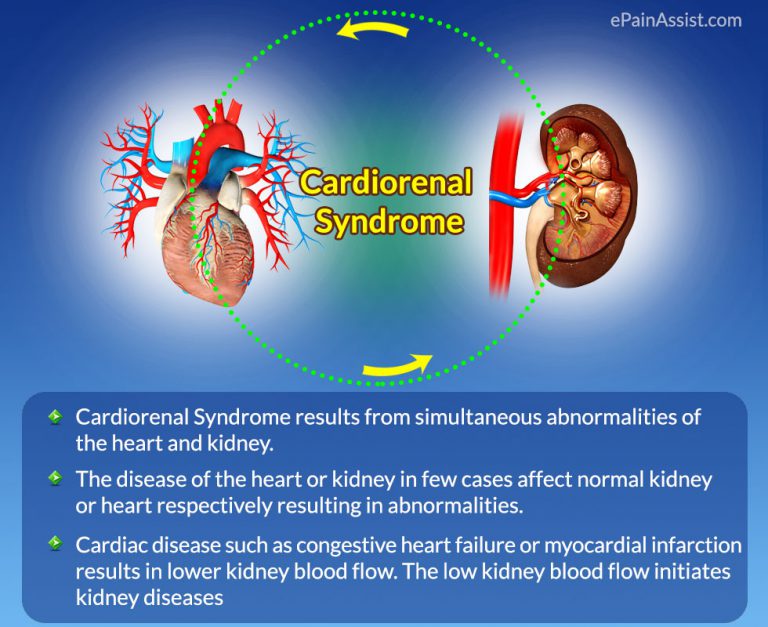 What is a Cardiorenal Syndrome, Know its Causes, Symptoms, Treatment, Prognosis, Classification, Effects, Risk Factors