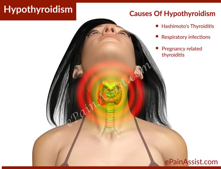 Hypothyroidism : Causes, Risk Factors, Signs & Symptoms, Treatment, Lifestyle Management, Diet, Exercise