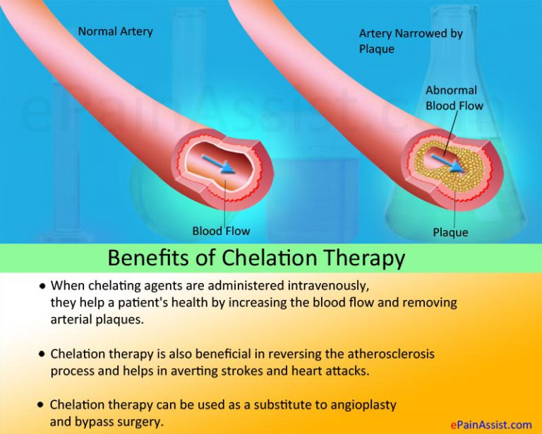 How Does Chelation Therapy Help In Treating Heart Disease?