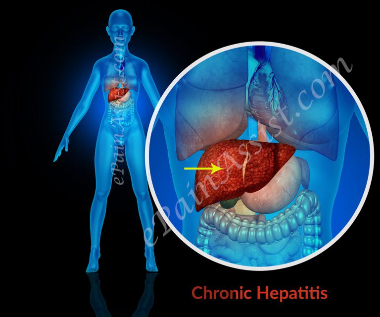 Chronic Hepatitis: Causes, Symptoms, Signs, Treatment, Prevention, Prognosis, Investigations