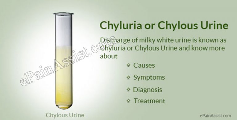 Chyluria or Chylous Urine: Causes, Symptoms, Diagnosis, Treatment- Sclerotherapy, Surgery