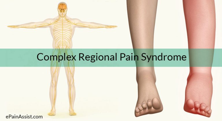 Complex Regional Pain Syndrome (CRPS): Types, Causes, Risk Factors, Signs, Symptoms, Treatment