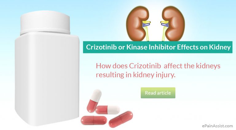 Crizotinib or Kinase Inhibitor Effects on Kidney: Kidney Toxicity, Kidney Injury