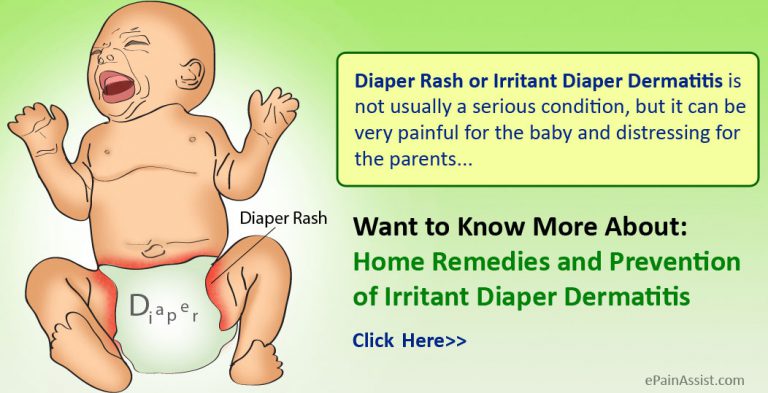 Diaper Rash or Irritant Diaper Dermatitis: Causes, Symptoms, Treatment, Home Remedies