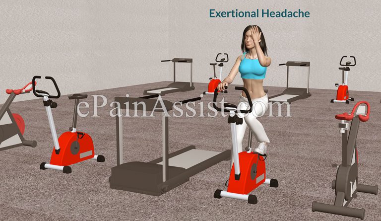 Exertional Headaches or Exercise Headaches: Causes, Symptoms, Treatment, Prevention