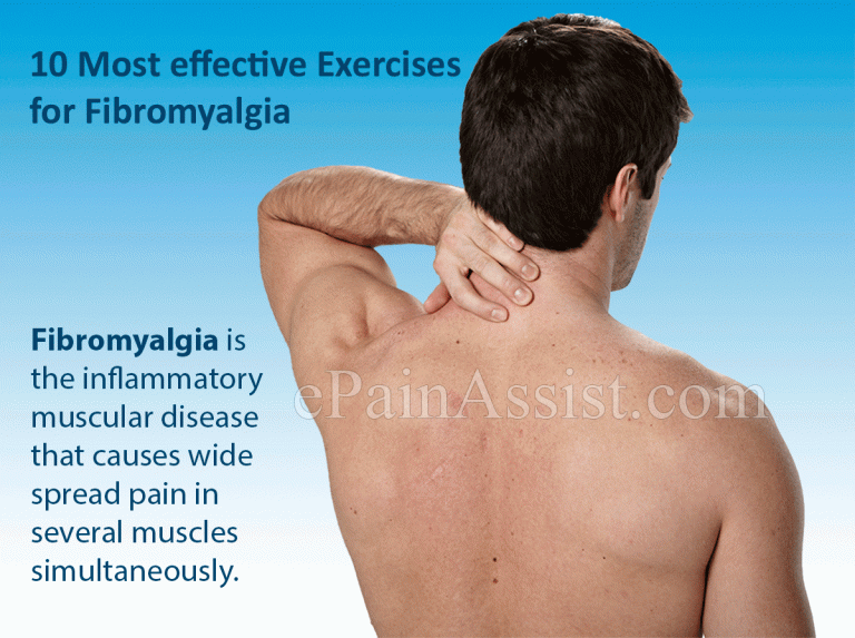 10 Best Exercises For Fibromyalgia