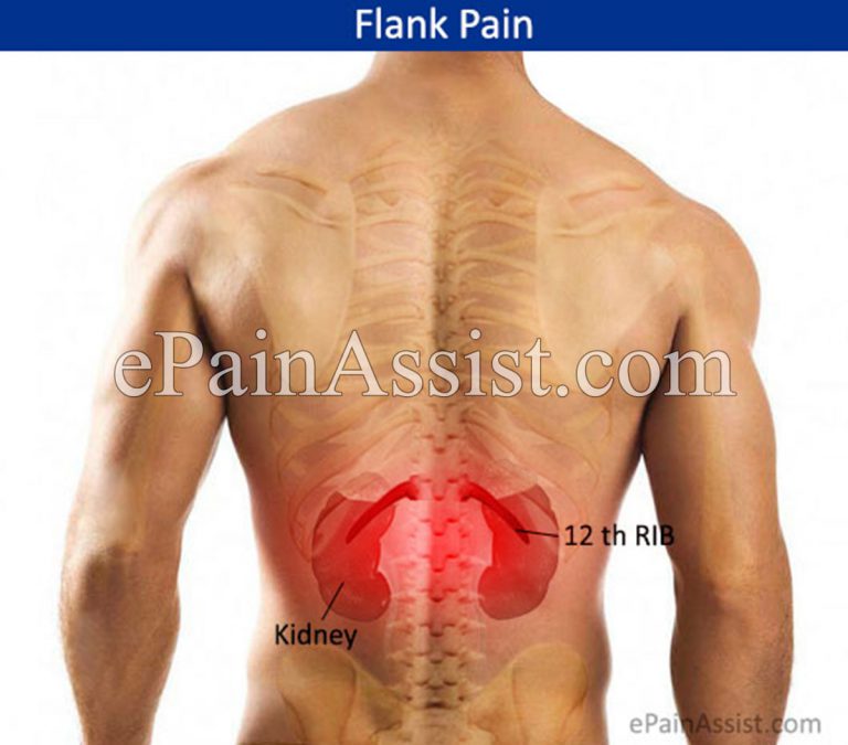 What Can Cause Pain In The Flank Region?