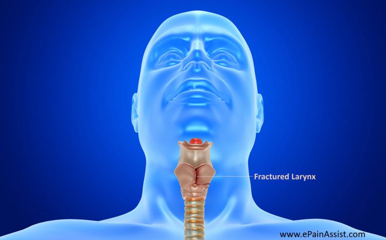 Fractured Larynx : Classification, Symptoms, Diagnosis, Treatment