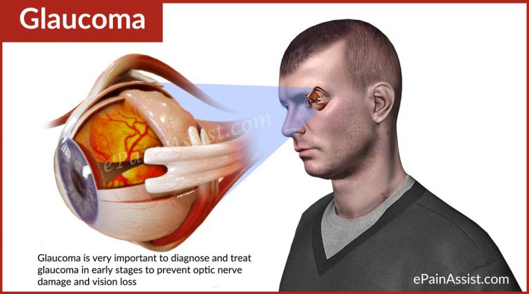 Glaucoma : Causes, Types, Signs, Treatment- Surgery, Laser, Filtering, Drainage Implants