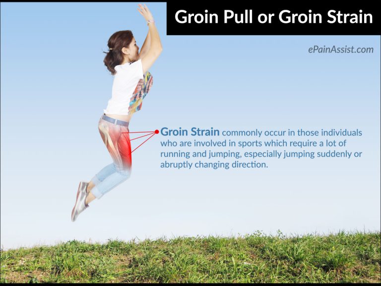 Groin Pull or Groin Strain: Symptoms, Treatment, Recovery, Prognosis, Prevention
