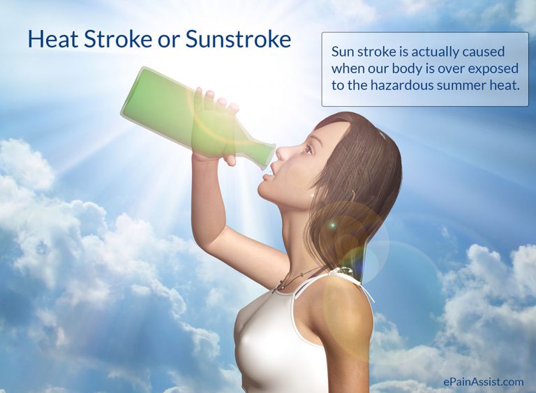 Heat Stroke or Sunstroke- An Ounce of Prevention is Worth a Pound of Cure