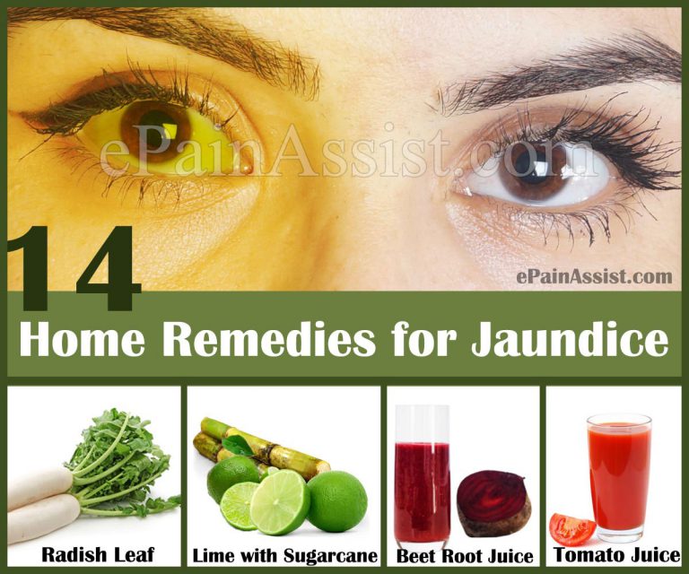 Home Remedies For Jaundice In Adults