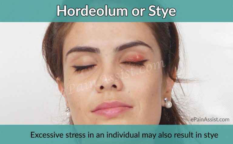 Stye (Sty) or Hordeolum : Causes, Symptoms, Treatment- Antibiotics, Analgesics