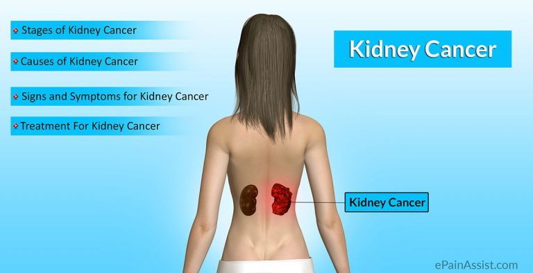 Kidney Cancer: Stages, Causes, Risk Factors, Signs, Symptoms, Tests, Treatment- Surgery